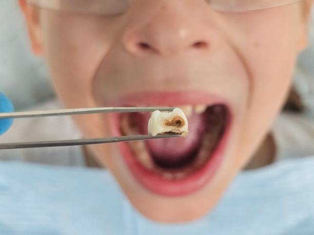 Best Emergency Treatment for Toothache in Coppell, TX